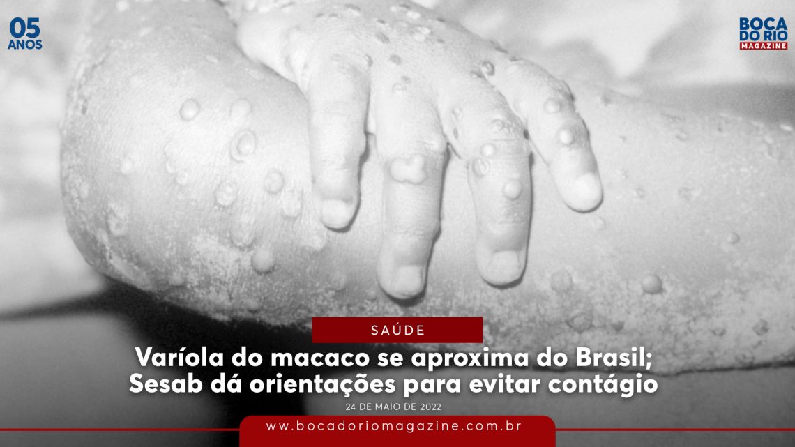 Varíola do macaco se aproxima do Brasil; Sesab dá orientações para evitar contágio