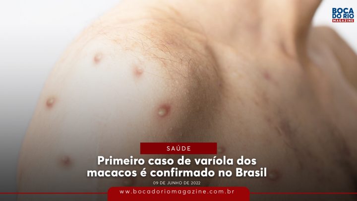 Primeiro caso de varíola dos macacos é confirmado no Brasil