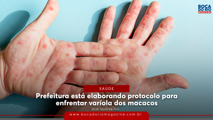 Prefeitura está elaborando protocolo para enfrentar varíola dos macacos