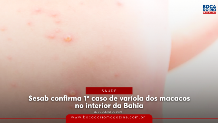 Sesab confirma 6º caso de varíola dos macacos na Bahia; veja detalhes