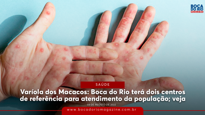 Varíola dos Macacos: Boca do Rio terá dois centros de referência para atendimento da população; veja
