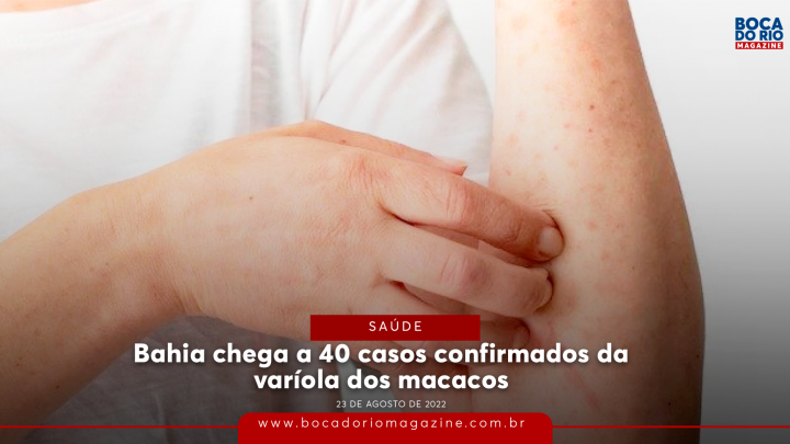 Bahia chega a 40 casos confirmados da varíola dos macacos