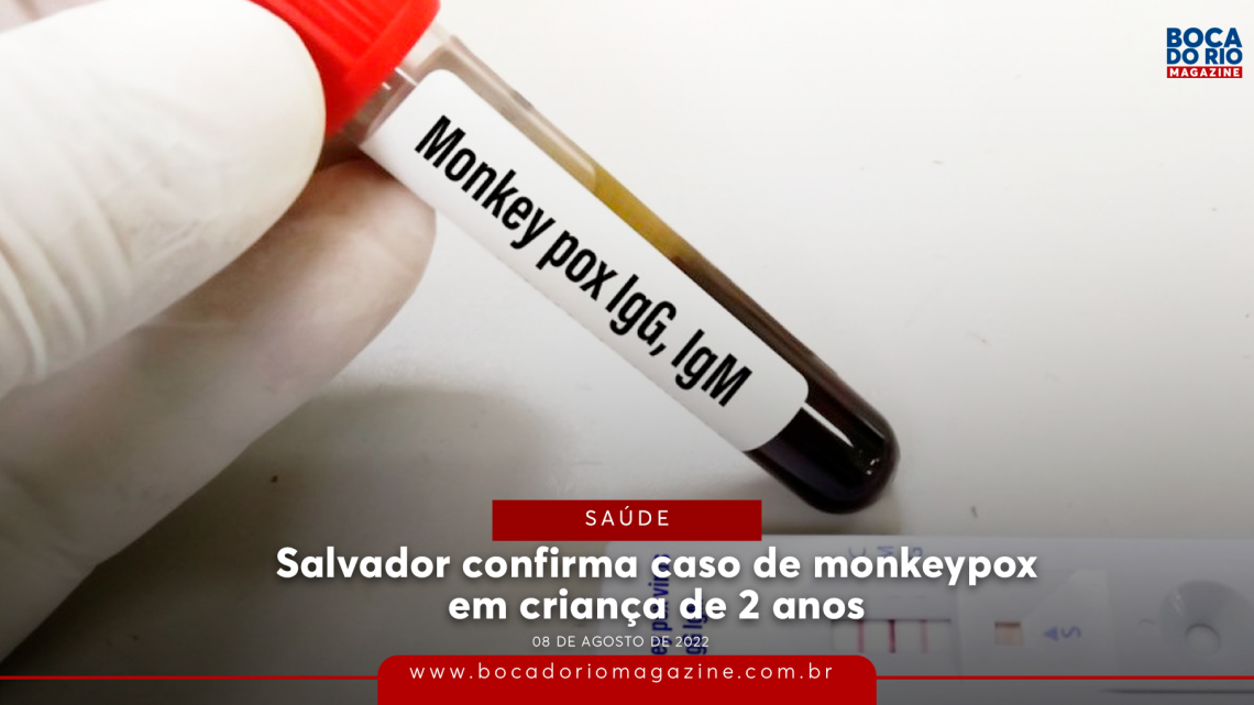 Salvador confirma caso de monkeypox em criança de 2 anos; saiba detalhes