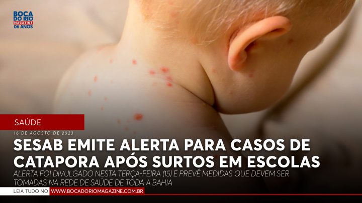 Secretaria de Saúde da Bahia emite alerta para casos de catapora após surtos em escolas