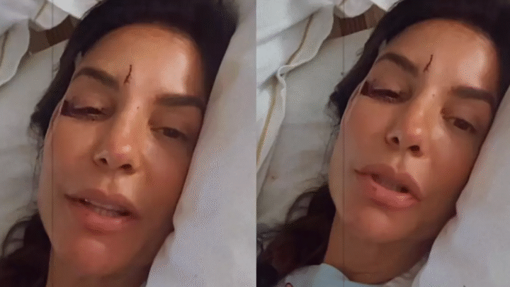 Por que Ivete Sangalo está com olho roxo? Entenda a internação da cantora