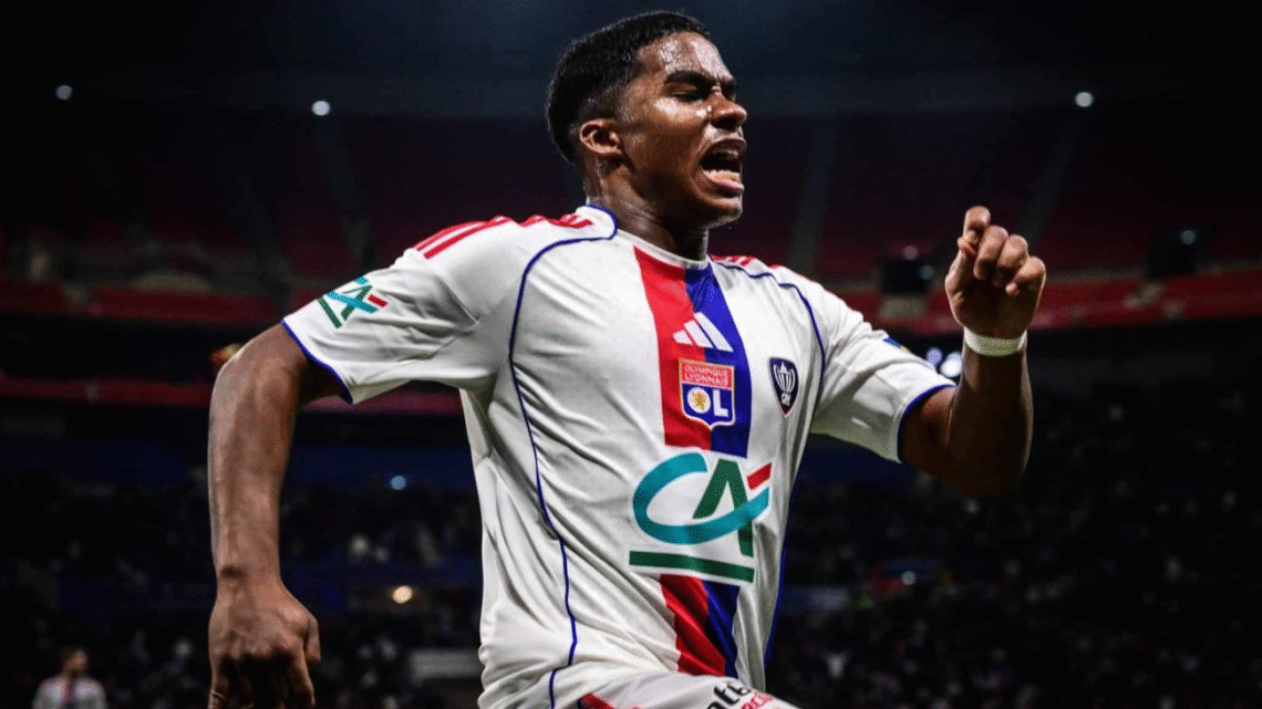 Onde ver o jogo Marselha x Lyon pelo Campeonato Francês