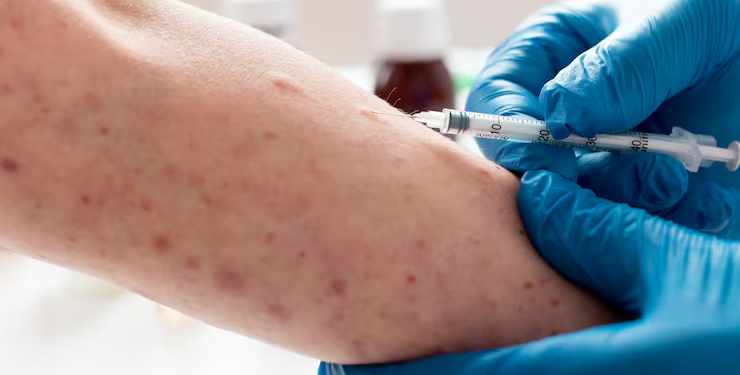 Sarampo volta a ameaçar o Brasil em 2026. Saiba como se vacinar e identificar os sintomas da doença contagiosa.