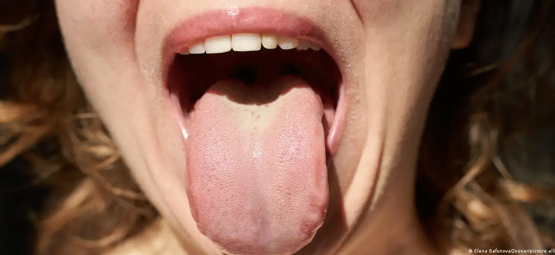 Câncer gástrico e colorretal podem ser identificados por bactérias da saliva segundo estudo